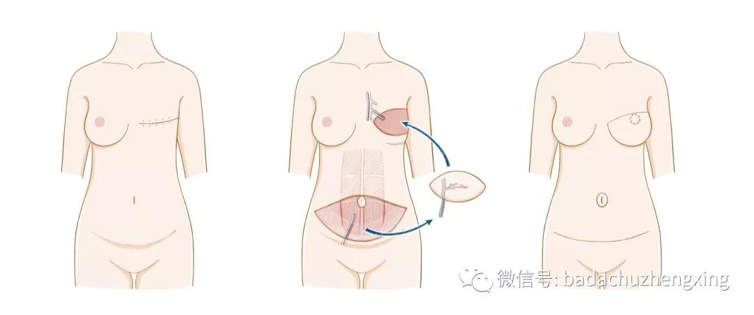 1592895669251.jpg 1592895669251.jpg