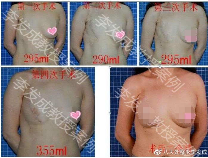 1600238870517.png 11111111111111.png