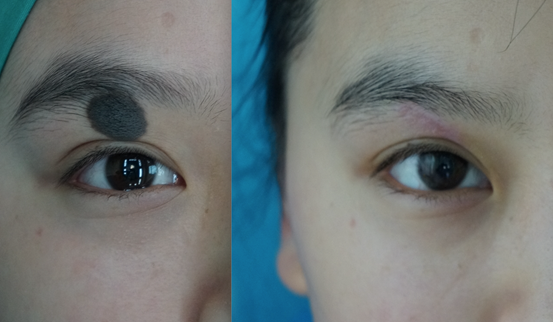 1646116886819.png 1646116886819.png