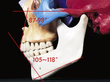 1585292158426.jpg 吕长胜 整牙的并发症和预防(附照)3.jpg