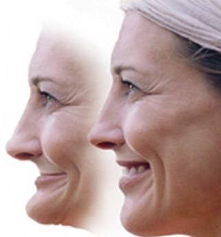 1585292170922.jpg 吕长胜 整牙的并发症和预防(附照)4.jpg