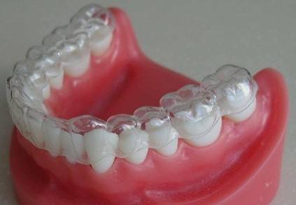 1585292229013.jpg 吕长胜 整牙的并发症和预防(附照)8.jpg