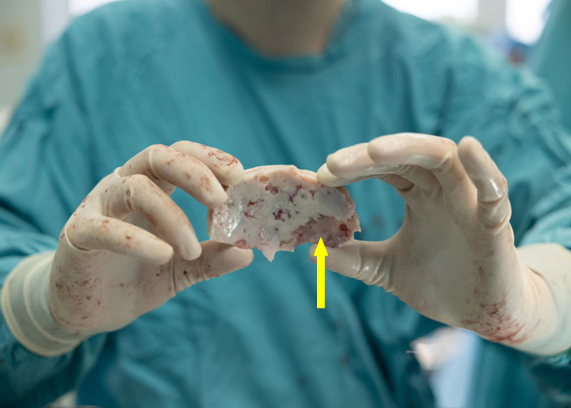 1652335162984.png 1652335162984.png