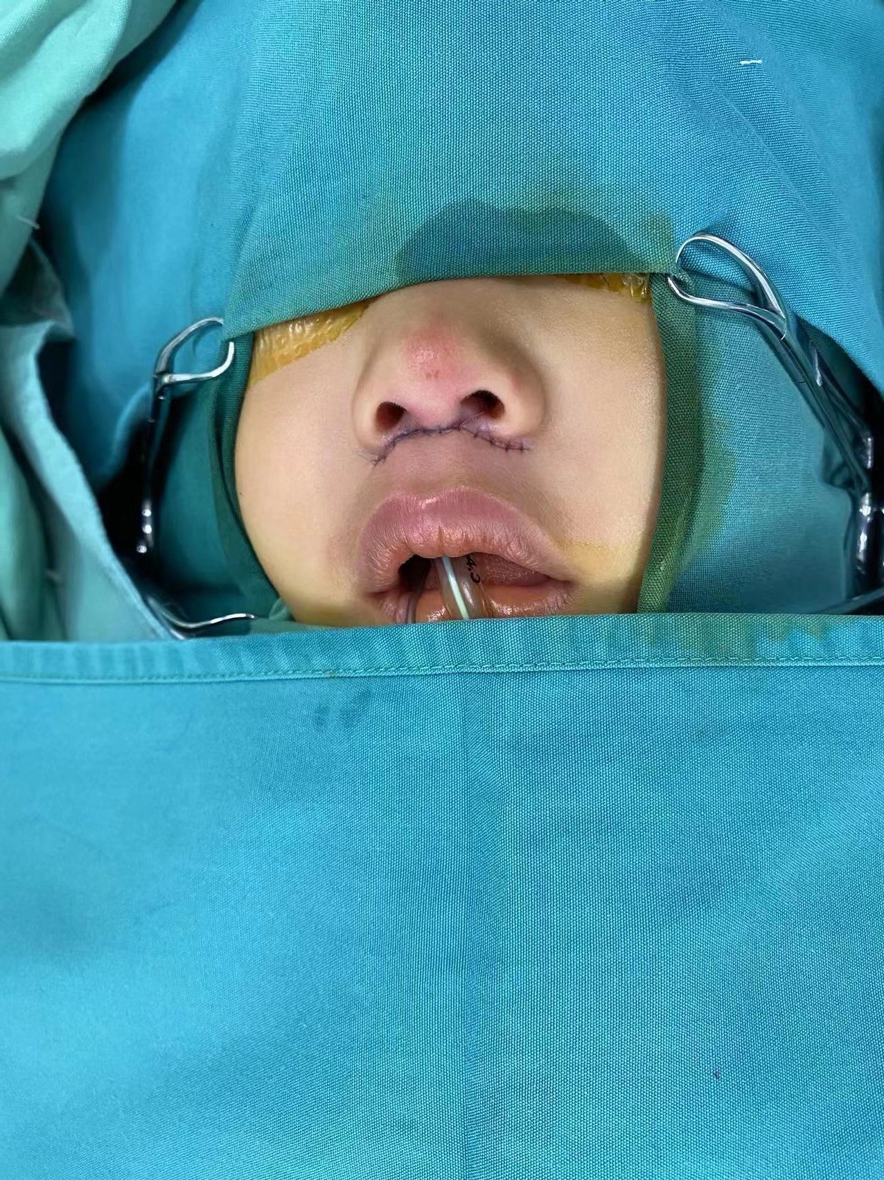 1692255416153.jpg 1692255416153.jpg