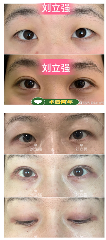 1709268636356.png 微信图片_20240301121817.png